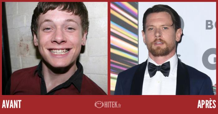 Antes / Después: ¿Cómo serán los actores de Skins en 2021? 24 1635438248 606 Antes Despues ¿Como seran los actores de Skins en