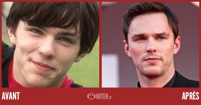 Antes / Después: ¿Cómo serán los actores de Skins en 2021? 8 1635438248 646 Antes Despues ¿Como seran los actores de Skins en