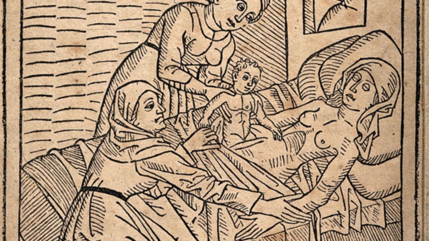 ¿Qué edad tiene el parto por cesárea?  |  hilo mental