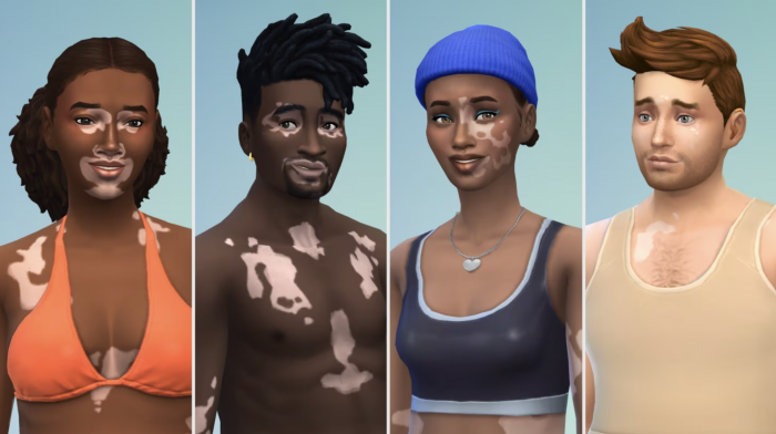 Los Sims 4 vitíligo