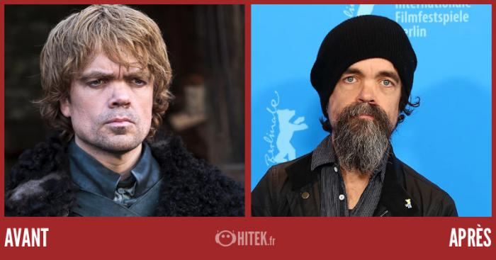 antes después juego de tronos 2024 peter dinklage