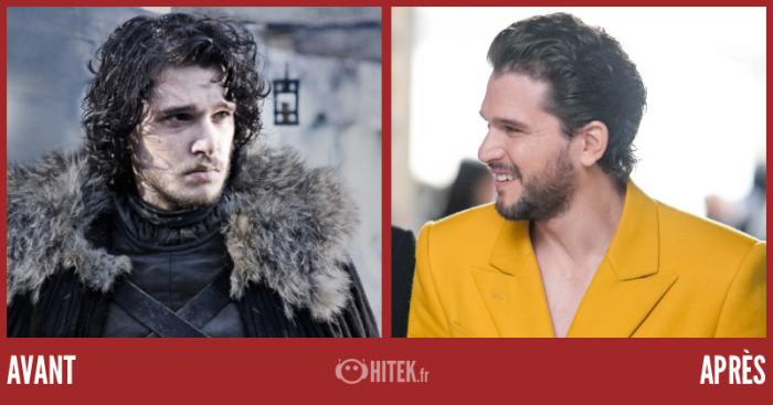 antes después juego de tronos 2024 kit harington