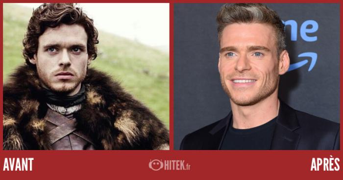 antes después juego de tronos 2024 richard madden